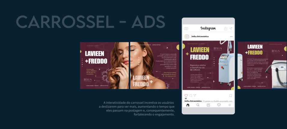 CARROSSEL 